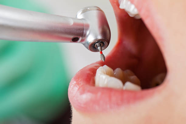 Best Mobile Emergency Dentist in Green Knoll, NJ